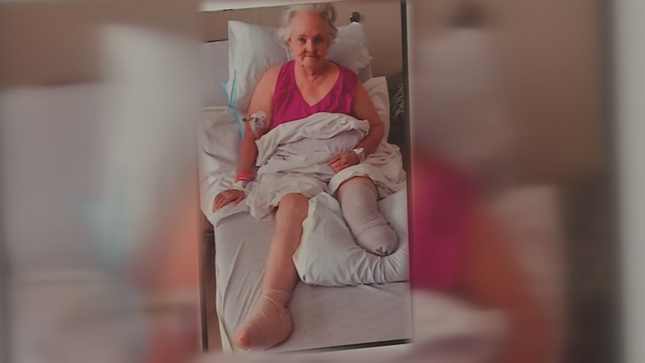Jury orders U of L Hospital to pay $10.5 million to woman whose leg was amputated after medical errors